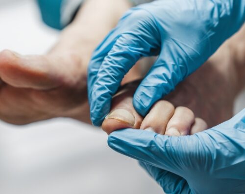Kingspoint Foot & Ankle Specialist
