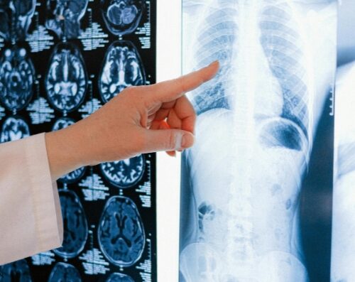 Rancho Open MRI