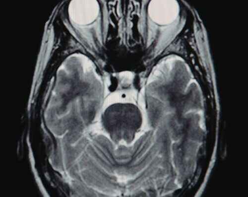 Synergexmed Neurologist & EMG / NCV